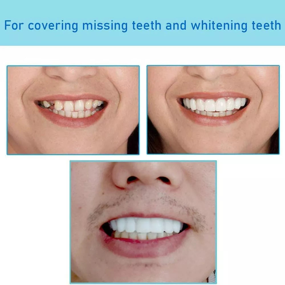 Transformez votre sourire instantanément – Renforcez votre confiance avec des facettes parfaites !