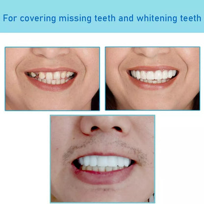 Transformez votre sourire instantanément – Renforcez votre confiance avec des facettes parfaites !