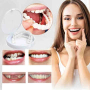 BrightDent SnapFit – Transform your smile with stunning aesthetic dental veneers