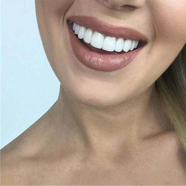 BrightDent SnapFit – Transform your smile with stunning aesthetic dental veneers