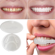 BrightDent SnapFit – Transform your smile with stunning aesthetic dental veneers