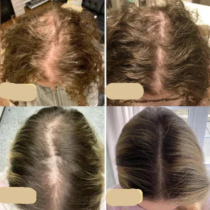 Revitalisez vos cheveux : Huile de croissance capillaire naturelle pour des cheveux robustes et luxueux