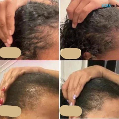 Revitalisez vos cheveux : Huile de croissance capillaire naturelle pour des cheveux robustes et luxueux